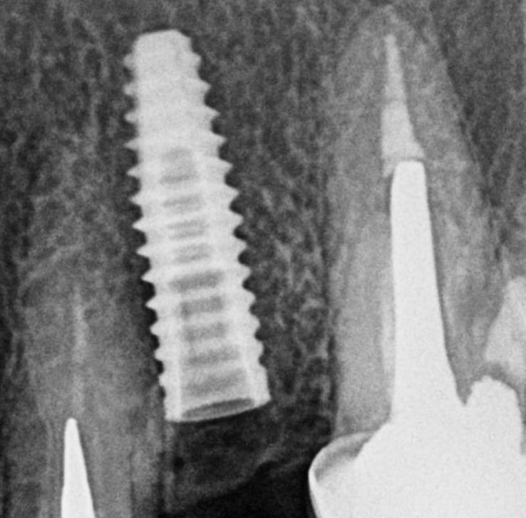 radiografia1
